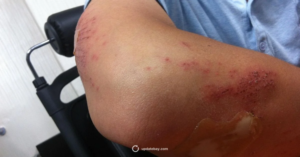 LeBron Injury Update - Update Bay